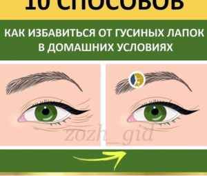 10 домашних средств от «гусиных лапок»